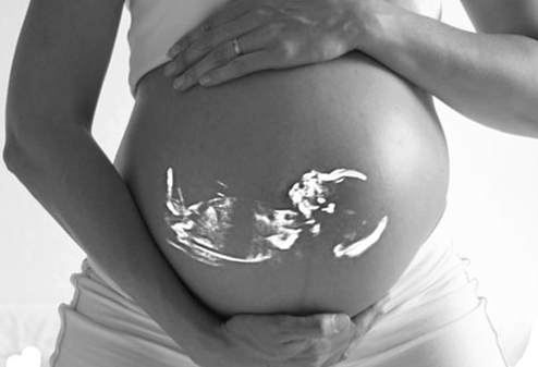 Laurence FIORINI sage-femme échographiste